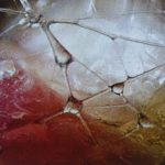 Dlaczego terapia nie działa? Niespecyficzne bóle mięśniowo – powięziowo – stawowe.